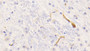 DAB staining on IHC-P; Samples: Mouse Cerebrum Tissue; Primary Ab: 20μg/ml Rabbit Anti-Mouse FGg Antibody Second Ab: 2µg/mL HRP-Linked Caprine Anti-Rabbit IgG Polyclonal Antibody