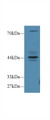 Western Blot; Sample: Human MCF7 cell lysate; Primary Ab: 1µg/ml Rabbit Anti-Human FBS Antibody Second Ab: 0.2µg/mL HRP-Linked Caprine Anti-Rabbit IgG Polyclonal Antibody