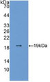 Western Blot; Sample: Recombinant ESM1, Human.