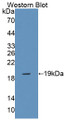 Western Blot; Sample: Recombinant protein.