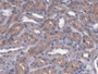 DAB staining on fromalin fixed paraffin- embedded kidney tissue)