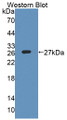 Western Blot; Sample: Recombinant protein.