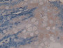 DAB staining on IHC-P; Samples: Rat Colon Tissue; Primary Ab: 30µg/ml Rabbit Anti-Rat ENDOG Antibody Second Ab: 2µg/mL HRP-Linked Caprine Anti-Rabbit IgG Polyclonal Antibody