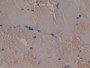 DAB staining on fromalin fixed paraffin- embedded Kidney tissue)