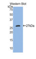 Western Blot; Sample: Recombinant protein.