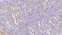 DAB staining on IHC-P; Samples: Mouse Kidney Tissue; Primary Ab: 20μg/ml Rabbit Anti-Mouse EDA Antibody Second Ab: 2µg/mL HRP-Linked Caprine Anti-Rabbit IgG Polyclonal Antibody