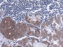 DAB staining on IHC-P; Samples: Human Stomach Tissue; Primary Ab: 20µg/ml Rabbit Anti-Human DST Antibody Second Ab: 2µg/mL HRP-Linked Caprine Anti-Rabbit IgG Polyclonal Antibody