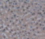 Used in DAB staining on fromalin fixed paraffin- embedded liver tissue