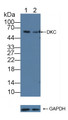 Knockout Varification: ; Lane 1: Wild-type HepG2 cell lysate; ; Lane 2: DKC knockout HepG2 cell lysate; ; Predicted MW: 58,48kd ; Observed MW: 58kd; Primary Ab: 1µg/ml Rabbit Anti-Human DKC Antibody; Second Ab: 0.2µg/mL HRP-Linked Caprine Anti-Rabbit IgG Polyclonal Antibody;
