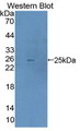 Western Blot; Sample: Recombinant protein.