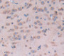 Doublecortin (Dcx) Polyclonal Antibody, Cat#CAU24278