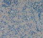 Diacylglycerol Kinase Alpha (Dgka) Polyclonal Antibody, Cat#CAU24281