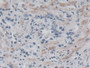 DAB staining on IHC-P. Samples: Human Tissue)