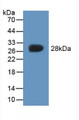 Western Blot; Sample: Recombinant CYGB, Rat.