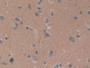 DAB staining on IHC-P; Samples: Human Brain Tissue; Primary Ab: 10µg/ml Rabbit Anti-Human CYLD Antibody Second Ab: 2µg/mL HRP-Linked Caprine Anti-Rabbit IgG Polyclonal Antibody