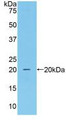 Western Blot; Sample: Recombinant CAT, Mouse.