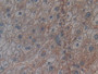 DAB staining on IHC-P; Samples: Human Liver Tissue;  Primary Ab: 30µg/ml Rabbit Anti-Human CRY1 Anti