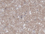 DAB staining on IHC-P; Samples: Human Cerebrum Tissue;  Primary Ab: 20µg/ml Rabbit Anti-Human CRMP1