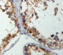 DAB staining on fromalin fixed paraffin-embedded testis tissue)