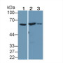 Western Blot; Sample: Lane1: Mouse Heart lysate; Lane2: Mouse Kidney lysate; Lane3: Mouse Skeletal muscle lysate &lt;br/&gt;Primary Ab: 2µg/mL Rabbit Anti-Human CRAT Ab&lt;br/&gt;Second Ab: 0.2µg/mL HRP-Linked Caprine Anti-Rabbit IgG Polyclonal Antibody&lt;br/&gt;