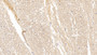 DAB staining on IHC-P; Samples: Human Cerebrum Tissue;  Primary Ab: 10µg/ml Rabbit Anti-Human CPLX1 Antibody Second Ab: 2µg/mL HRP-Linked Caprine Anti-Rabbit IgG Polyclonal Antibody 