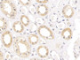 DAB staining on IHC-P; Samples: Human Kidney Tissue; Primary Ab: 10µg/ml Rabbit Anti-Human CLDN1 Antibody Second Ab: 2µg/mL HRP-Linked Caprine Anti-Rabbit IgG Polyclonal Antibody