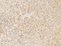 DAB staining on fromalin fixed paraffin-embedded Kidney tissue)