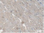 DAB staining on IHC-P; Samples: Rat Heart Tissue.