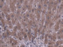 DAB staining on IHC-P; Samples: Human Liver Tissue; Primary Ab: 20µg/ml Rabbit Anti-Human CES1 Antibody Second Ab: 2µg/mL HRP-Linked Caprine Anti-Rabbit IgG Polyclonal Antibody