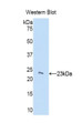 Western Blot; Sample: Recombinant protein.