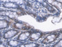 DAB staining on IHC-P; Samples: Mouse Colon Tissue;  Primary Ab: 20µg/ml Rabbit Anti-Mouse CBR1 Anti