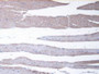 Figure. DAB staining on IHC-P; Samples: Mouse Skeletal Muscle Tissue.