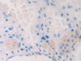 DAB staining on IHC-P; Samples: Human Kidney Tissue;  Primary Ab: 10µg/ml Rabbit Anti-Human CAPN2 An