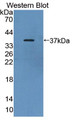 Western Blot; Sample: Recombinant protein.