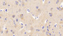 DAB staining on IHC-P; Samples: Human Cerebrum Tissue; Primary Ab: 20μg/ml Rabbit Anti-Human CAMLG Antibody Second Ab: 2µg/mL HRP-Linked Caprine Anti-Rabbit IgG Polyclonal Antibody