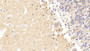 DAB staining on fromalin fixed paraffin- embedded Kidney tissue)