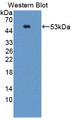 Western Blot; Sample: Recombinant protein.