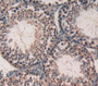 Used in DAB staining on fromalin fixed paraffin- embedded Kidney tissue