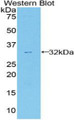 Western Blot; Sample: Recombinant protein.