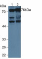 Western Blot; Sample: Lane1: Human Serum; Lane2: Human Hela Cells.