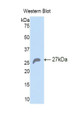 Western Blot; Sample: Recombinant protein.