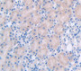 Heat Shock 70Kda Protein 5 (Hspa5) Polyclonal Antibody, Cat#CAU24385