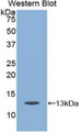 Western Blot; Sample: Recombinant protein.