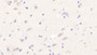 DAB staining on IHC-P; Samples: Human Cerebrum Tissue;  Primary Ab: 20μg/ml Rabbit Anti-Human BEST1 Antibody Second Ab: 2µg/mL HRP-Linked Caprine Anti-Rabbit IgG Polyclonal Antibody 