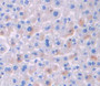 Used in DAB staining on fromalin fixed paraffin- embedded liver tissue