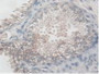 DAB staining on IHC-P; Samples: Human Prostate Gland Tissue.