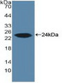 Western Blot; Sample: Recombinant ARO, Human.