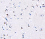 Used in DAB staining on fromalin fixed paraffin- embedded Kidney tissue