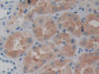 DAB staining on IHC-P; Samples: Human Kidney Tissue;  Primary Ab: 10µg/ml Rabbit Anti-Human ASS1 Ant