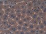 DAB staining on IHC-P; Samples: Mouse Liver Tissue; Primary Ab: 20µg/ml Rabbit Anti-Mouse APC Antibody Second Ab: 2µg/mL HRP-Linked Caprine Anti-Rabbit IgG Polyclonal Antibody